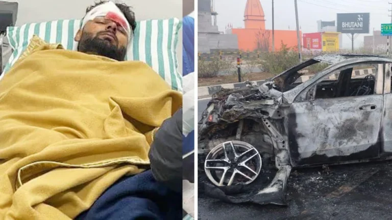 Rishabh Pant Car Accident: बाल-बाल बच गए ऋषभ पंत जाने कितनी गहरी चोटें आई