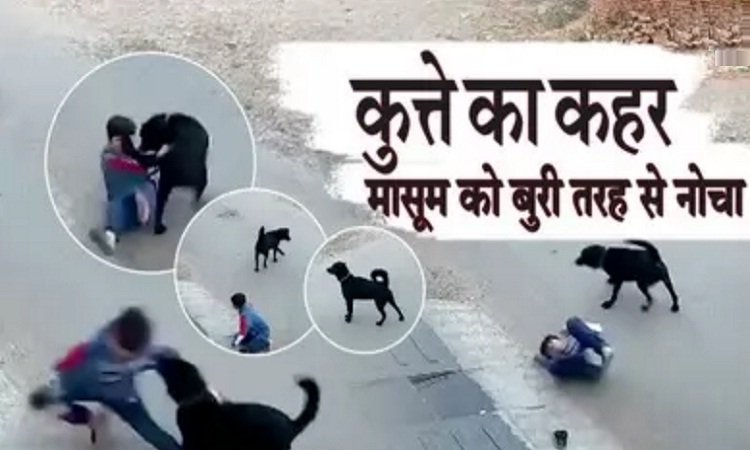 Dog Attack on Child